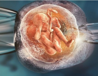 Семейному суду Беэр-Шевы пришлось разбирать право двух женщин зачать от одного покойного донора